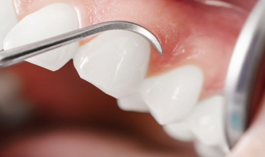 Factores clave en el diagnóstico y abordaje de la enfermedad periodontal.