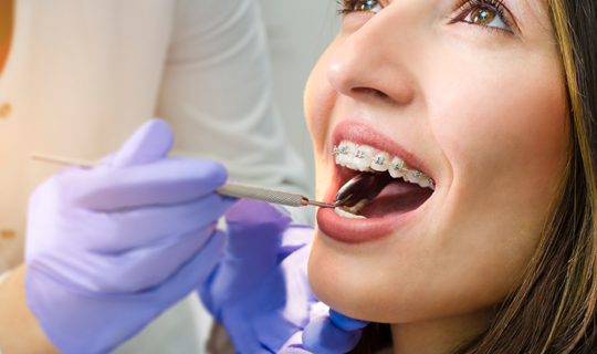 Higiene para pacientes con ortodoncia