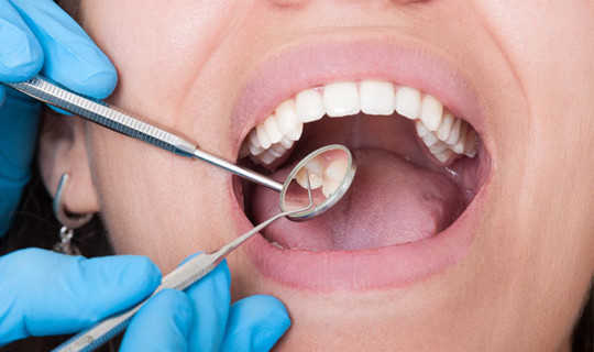Tratamiento de las caries dentales