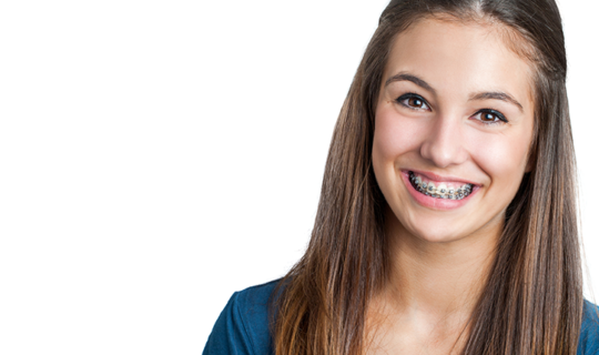 Tipos de ortodoncia: ventajas y desventajas
